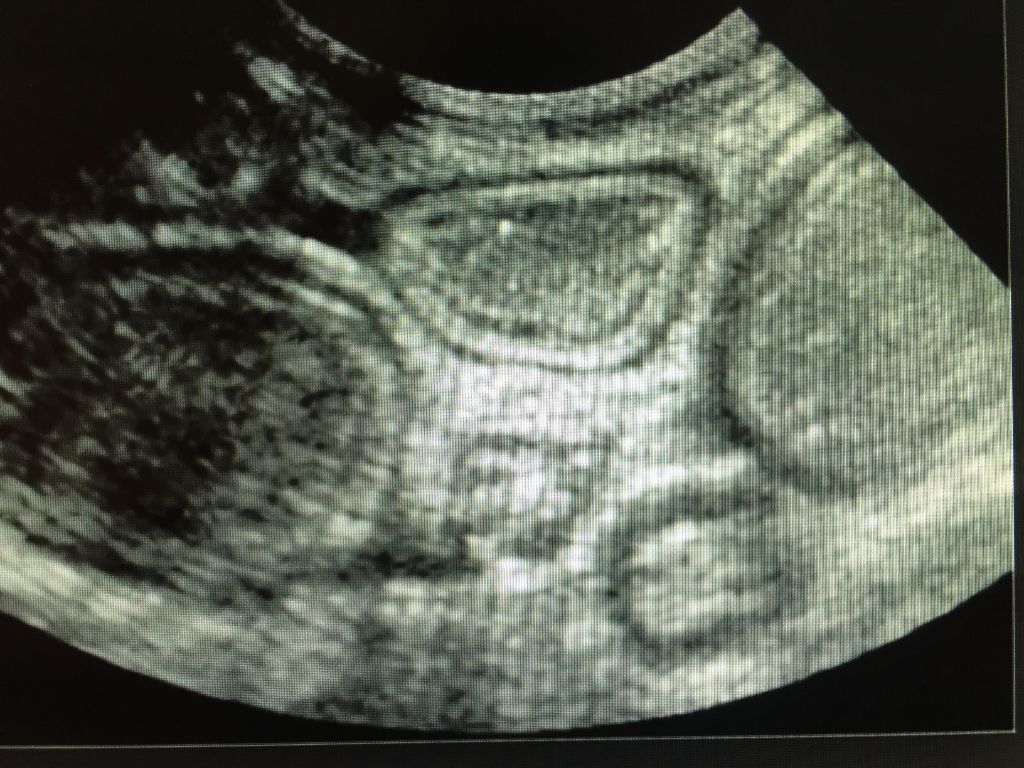 Du Clos De La Saliais - Confirmation de gestation pour Nan
